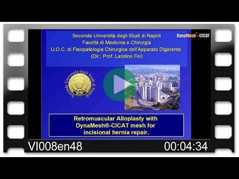 DynaMesh®-CICAT - OR-Video: Retromuscular Alloplasty with DynaMesh®-CICAT Mesh for Incisional Hernia