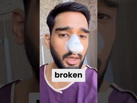 Impact of Nose Surgery - Anshul Jubli #ufcindia