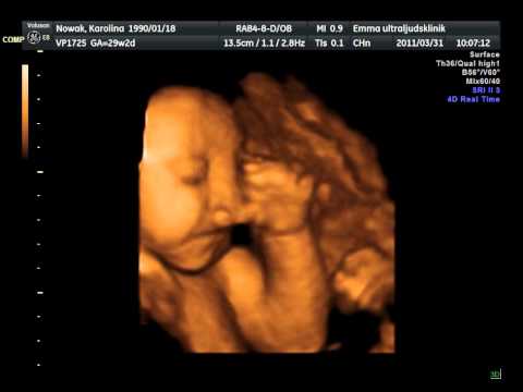 Leia Nowak i graviditetsvecka 30 - Del. I