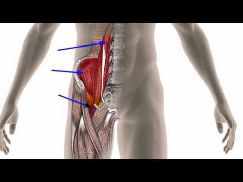 Trigger Point Therapy - Iliopsoas