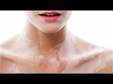 Crema 999 da pigmentazione Le maschere per candeggiare di pelle secca