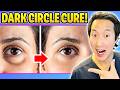 Plastic Surgeon How To Get Rid Of Dark Circles Of Undereyes