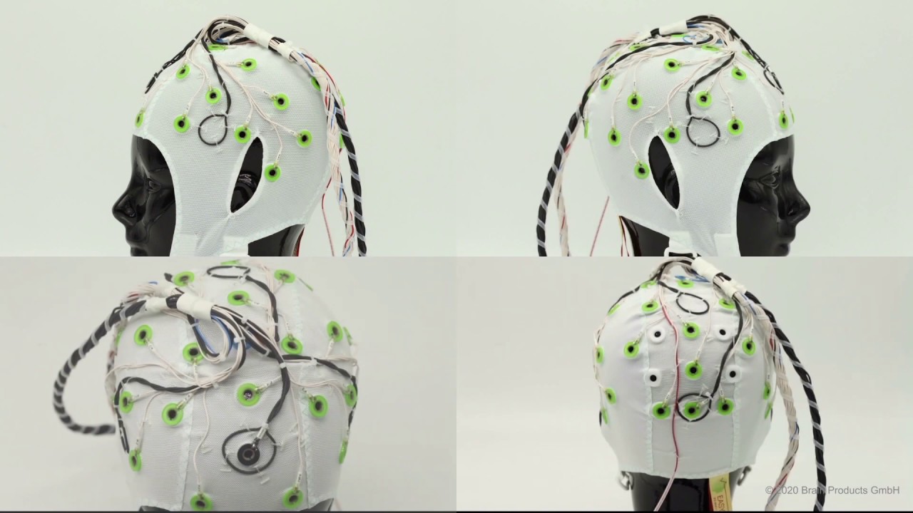 Introducing Carbon Wire Loops for the BrainCap MR
