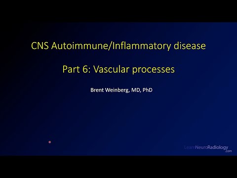 Imaging CNS autoimmune and inflammatory disease - 6 - Vascular