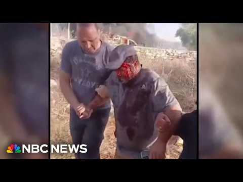 Israeli settlers attack American journalist in West Bank
