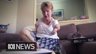 Thalidomide survivor Trish Jackson uses her disability to open minds