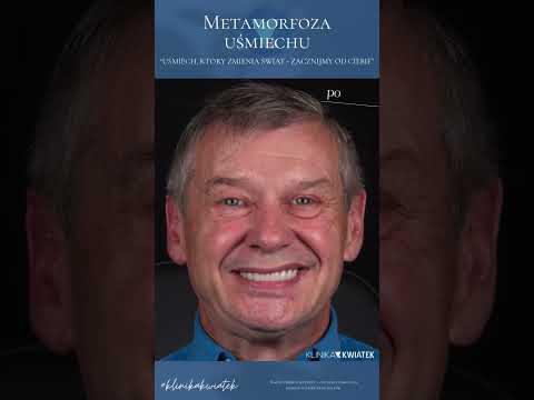 Oskar Barczak-8