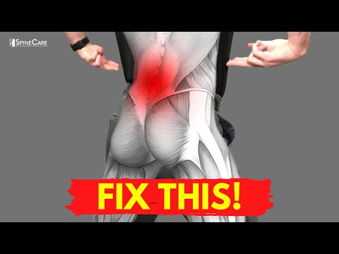 How to Fix Your Lower Back Pain for Good