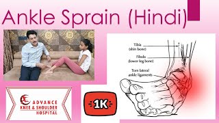 Ankle  sprain(Hindi) पैर /एड़ी  की मोच : इलाज और उपचार. टखने में मोच।  टखने का दर्द