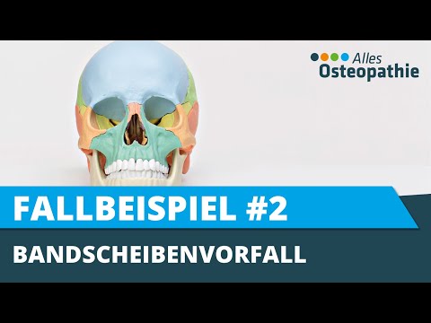 Bandscheibenvorfall einfach erklärt. Ursachen aus osteopathischer Sicht.