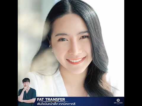 เติมไขมันหน้าเด็ก Dr. Chen เติมไขมันหน้าเด็ก Dr. Chen