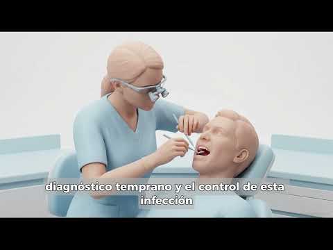 INTERVENCION DE ENFERMERIA EN ENFERMEDADES PERIODONTALES