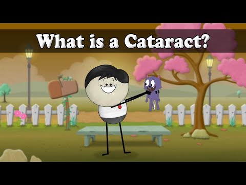 什麼是白內障？| 白內障是什麼？ (What is a Cataract? | #aumsum)