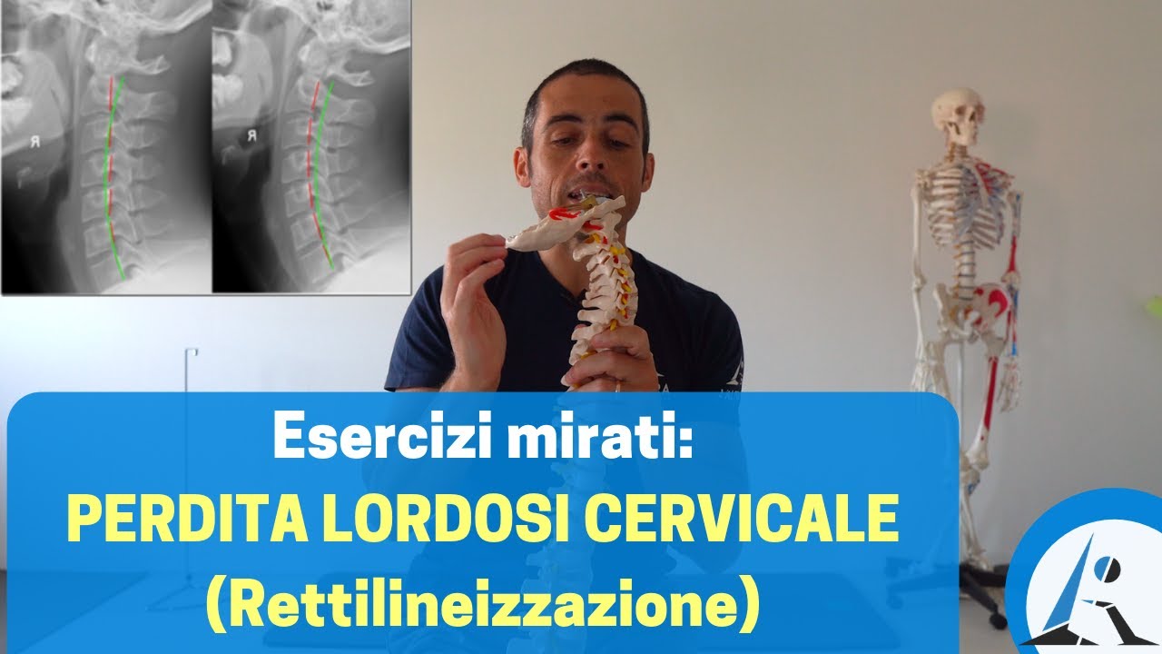 PERDITA della LORDOSI CERVICALE (rettilineizzazione): protocollo di ESERCIZI