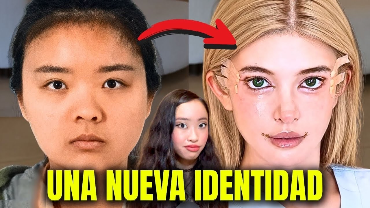 La CIRUGÍA para "CAMBIAR DE RAZA" en China: La nueva obsesión de los influencers