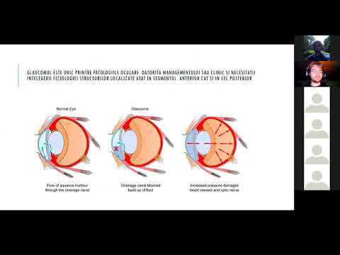 Oculus centru oftalmologic