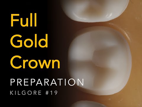 Full Gold Crown #19 Kilgore | Full Metal Crown Preparation