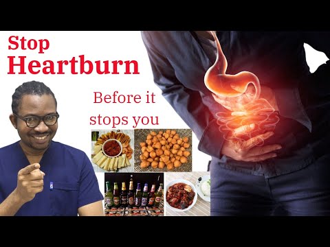 Heartburn Tips By Nigerian Doctor | Surprising causes of Stomach Ulcers in Africans |Gastritis Cause