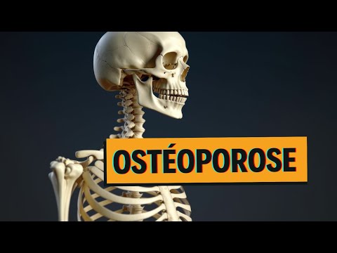 Ostéoporose