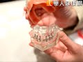 老人也能哺土豆　小鈕扣假牙不鬆動