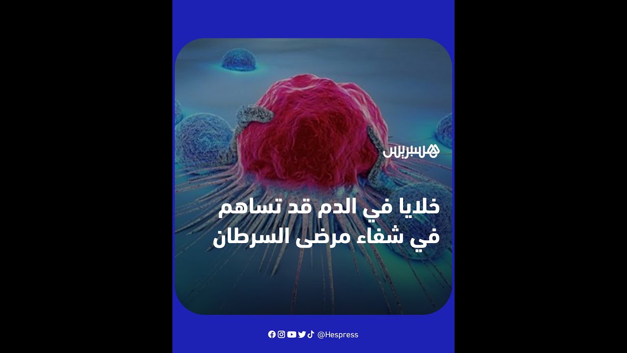 بُشرى لمصابي السرطان.. اكتشاف دواء حي في دم ناجٍ من المرض thumbnail