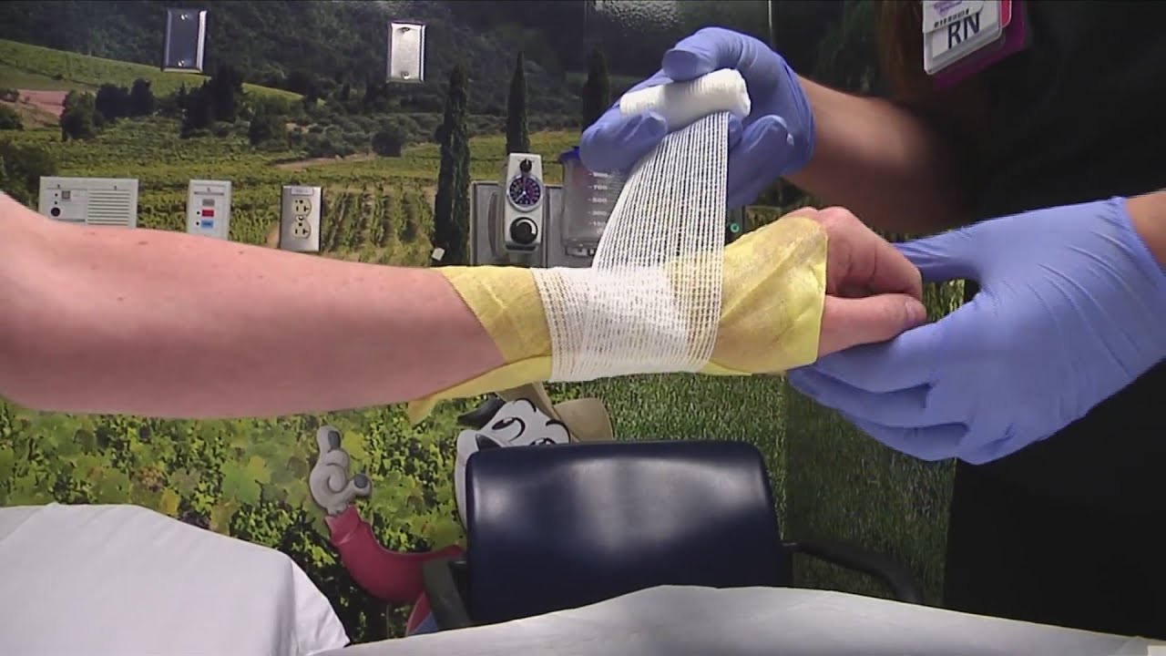 MedWatch Today: Treating Burns