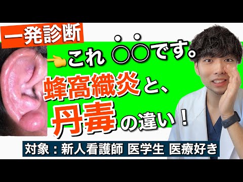 丹毒について詳しく解説