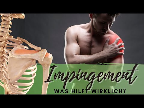 Impingement Syndrom: Effektive Übungen bei Schulterschmerzen durch subacromiale Enge (+ Tests)