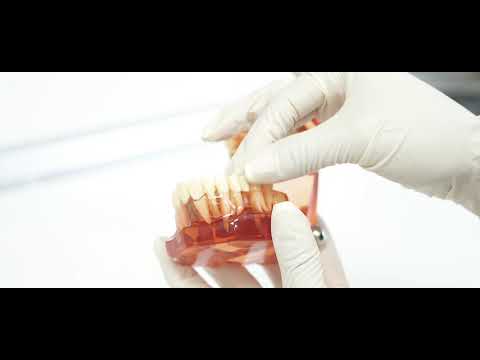 Casos Colomer - Diseño de sonrisas