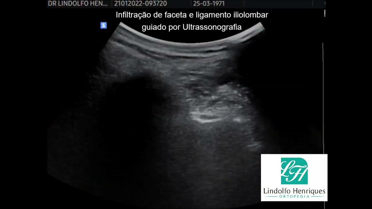 Lindolfo Henriques-11
