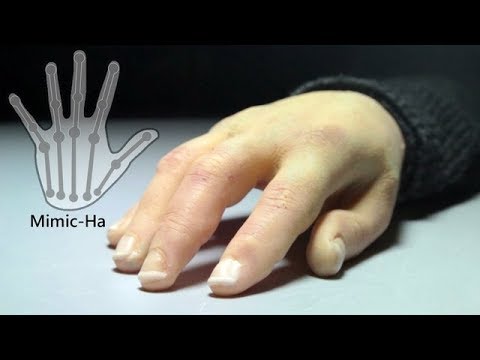 Mimic-Ha: Animatronic/Prosthetic Hand with realistic human appearance