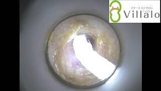 耳掃除動画vol.45「半年間耳かき封印」