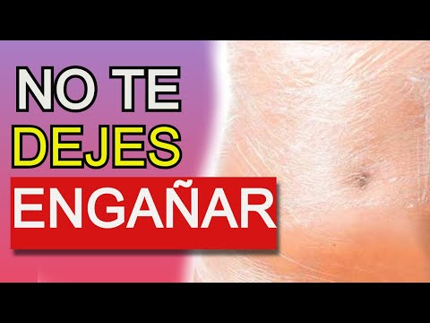 Tea slimming itim o green tea Magsanay larawan para sa pagbaba ng timbang para sa linggo