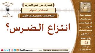 صورة حكم انتزاع الضرس للصائم – الشيخ صالح الفوزان
