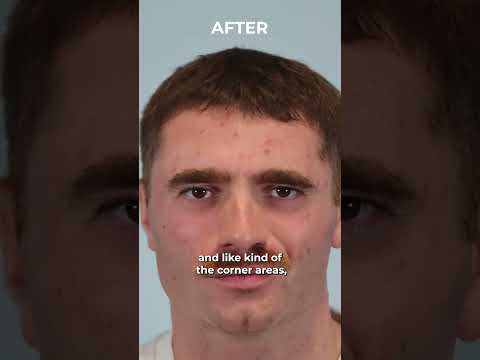 Leong Hair Restoration