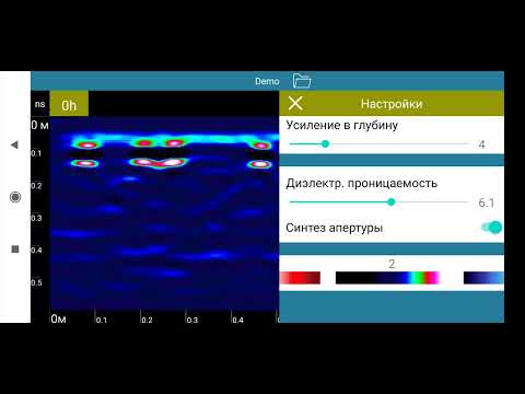ArmScan