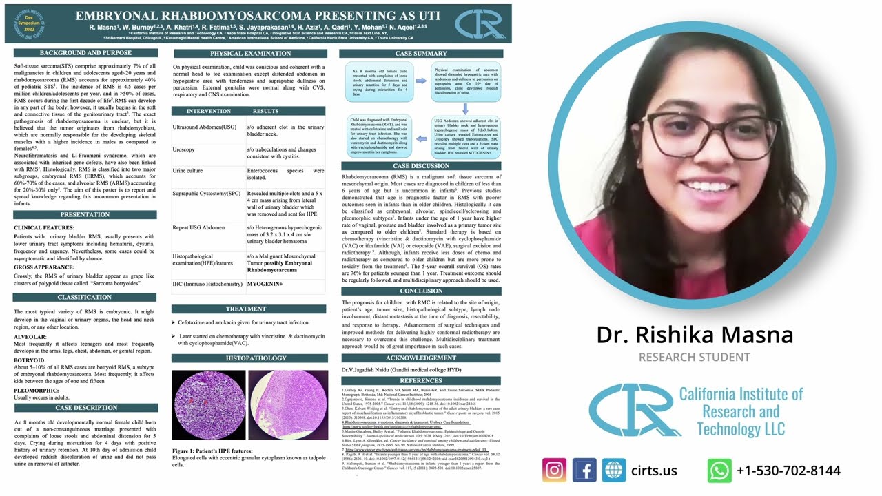 Embryonal Rhabdomyosarcoma - Dr. Rishika Masna