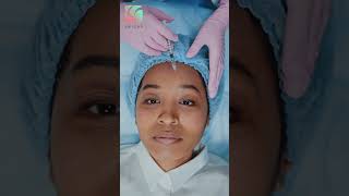 Download lagu Beda Filler dan Skin Booster #shorts mp3 Download lagu Beda Filler dan Skin Booster #shorts mp3