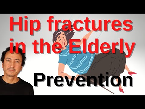 5 Ways to prevent hip fractures