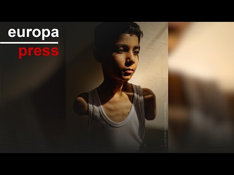 La imagen de Mahmoud, un niño mutilado de Gaza, foto del año del World Press Photo