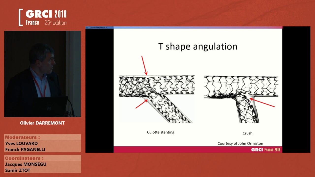 Le Tronc Commun : une bifurcation différente - GRCI 2018