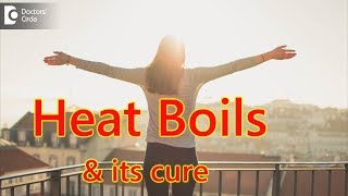 What causes Heat Boils & its cure? - Dr. Mini Nair