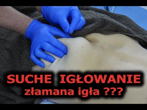 SUCHE IGŁOWANIE - ZŁAMANA IGŁA ? DONGBANG SOMA CLOUD&DRAGON SERIN