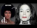 How Much Plastic Surgery Did Michael Jackson Actually Have NEW DETAILS The Detail