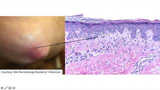 DP60 episode 82 red elbow