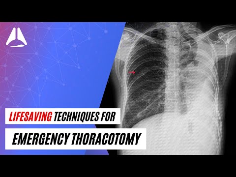 Emergency Needle/Finger/Pigtail Thoracotomy by Dr Dave | #anesthesia #anaesthesia #medicalprocedures