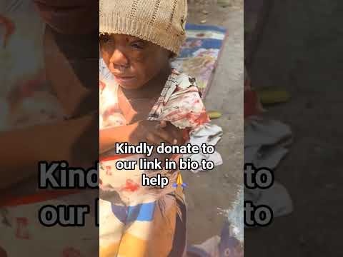 Kindly donate to our link in bio to help #foryou #fyp #Florida #baby