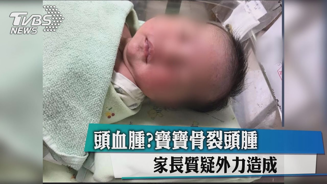 頭血腫?寶寶骨裂頭腫 家長質疑外力造成