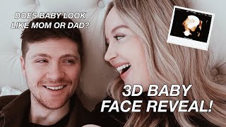 OUR 3D/4D ULTRASOUND AT 26 WEEKS + HUSBAND SEES BABY FOR THE FIRST TIME!!! (UC BABY)