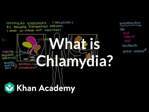 viziune chlamydia